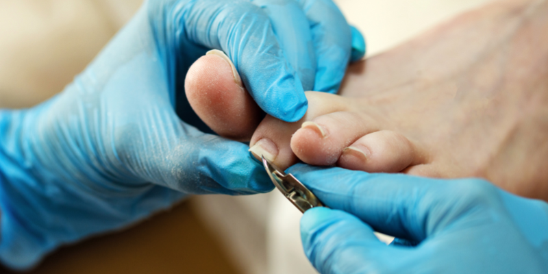 medisch pedicure voor pijnlijke voeten